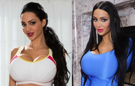 Amy Anderssen